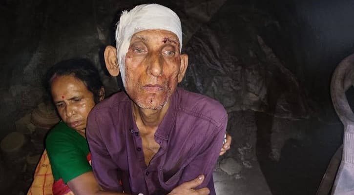 Hindu Gold Merchant Hacked, Robbed of Silver, Gold and Cash